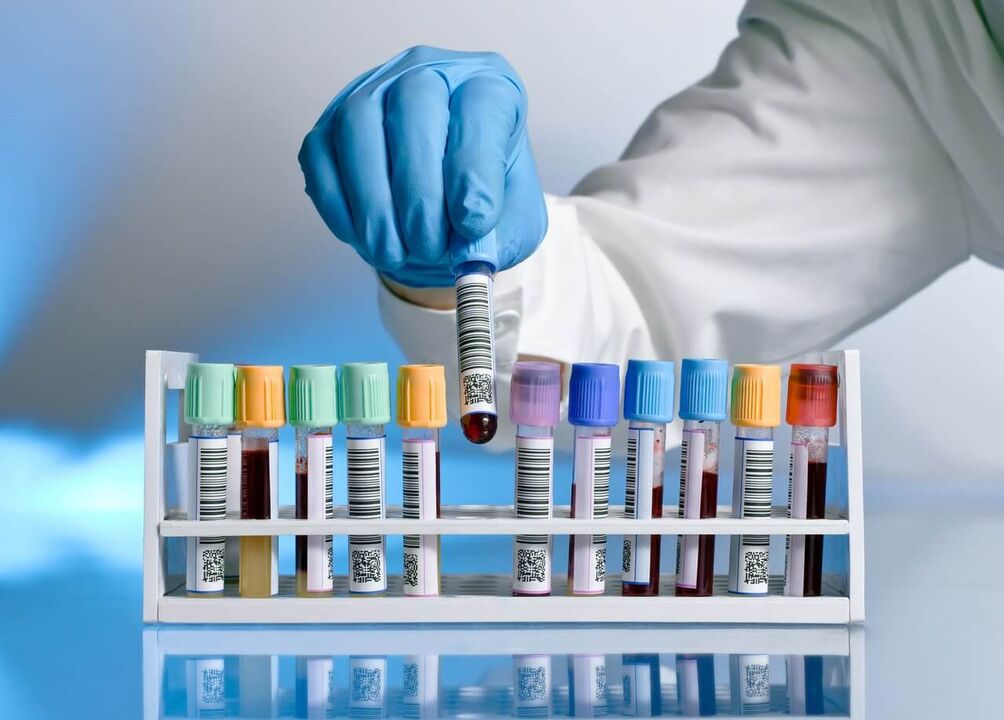 آزمایش خون برای ترشحات پاتولوژیک در هنگام برانگیختگی