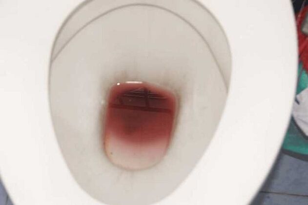 لکه بینی در مردان هنگام هیجان